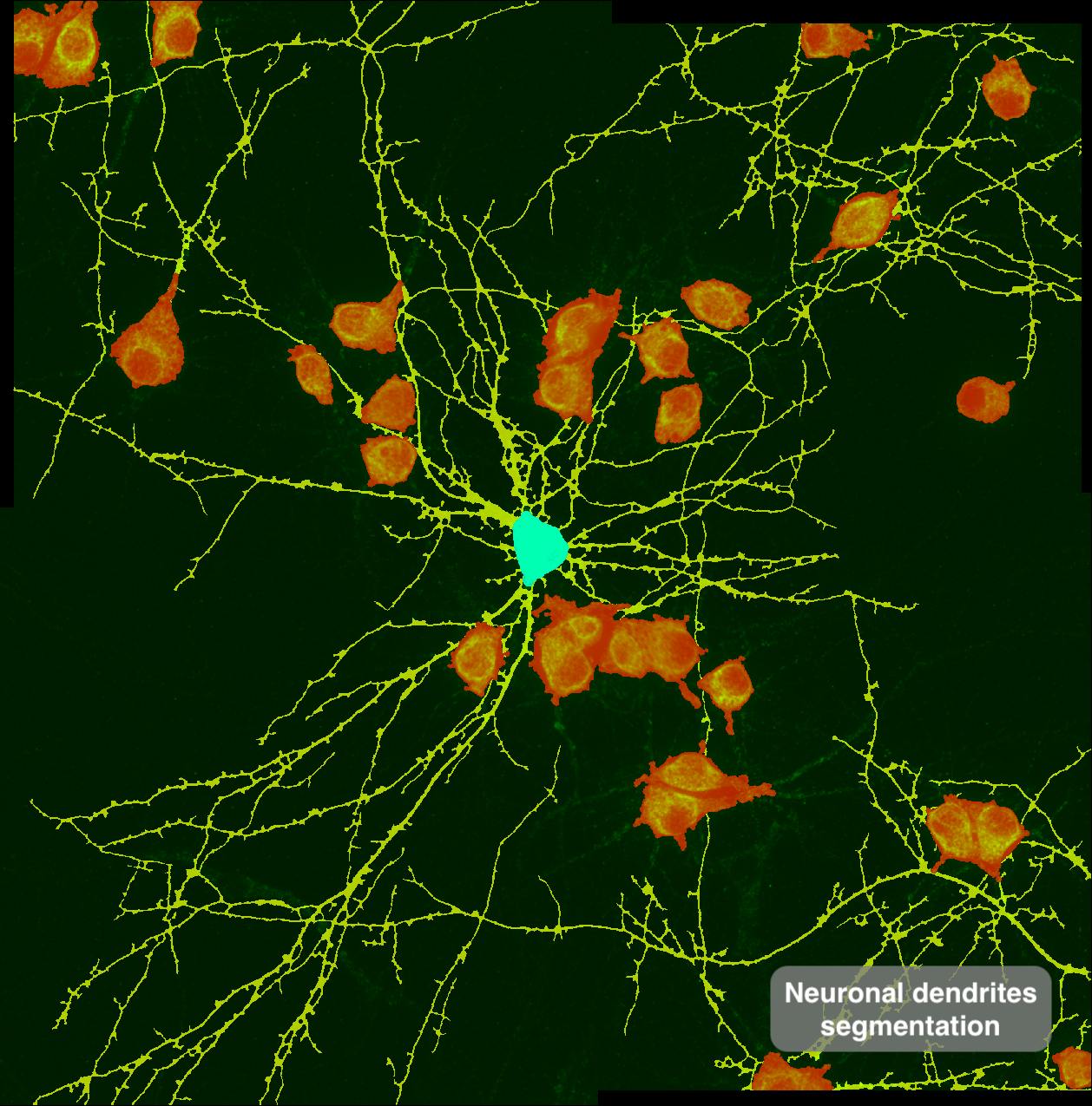 neuronal-dendrites-annotated.png